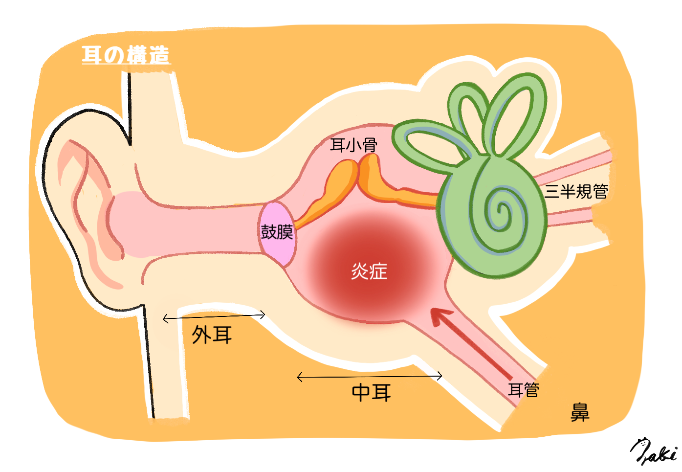 中耳炎