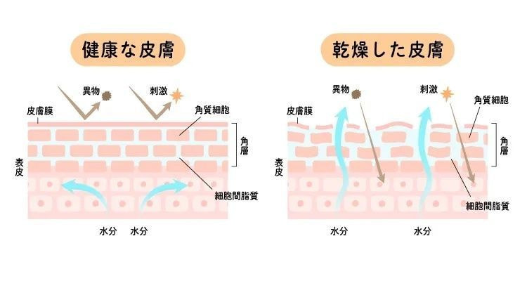 健康な肌と乾燥した肌のイラスト