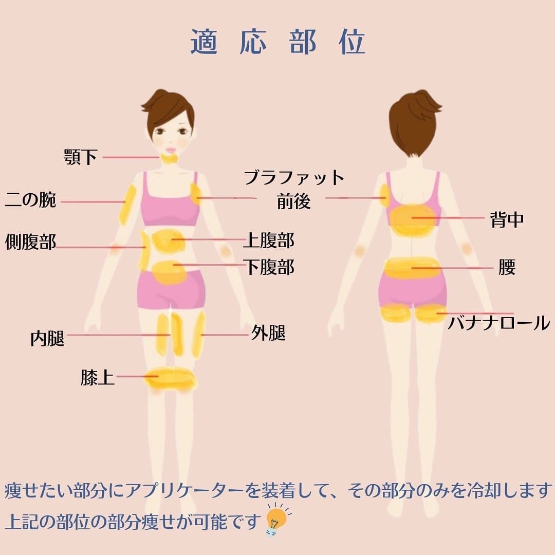 クールスカルプティングの適応部位の案内