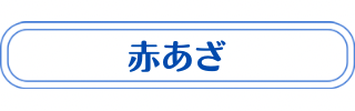 赤あざ説明・治療法