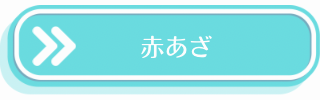 赤あざ説明・治療法